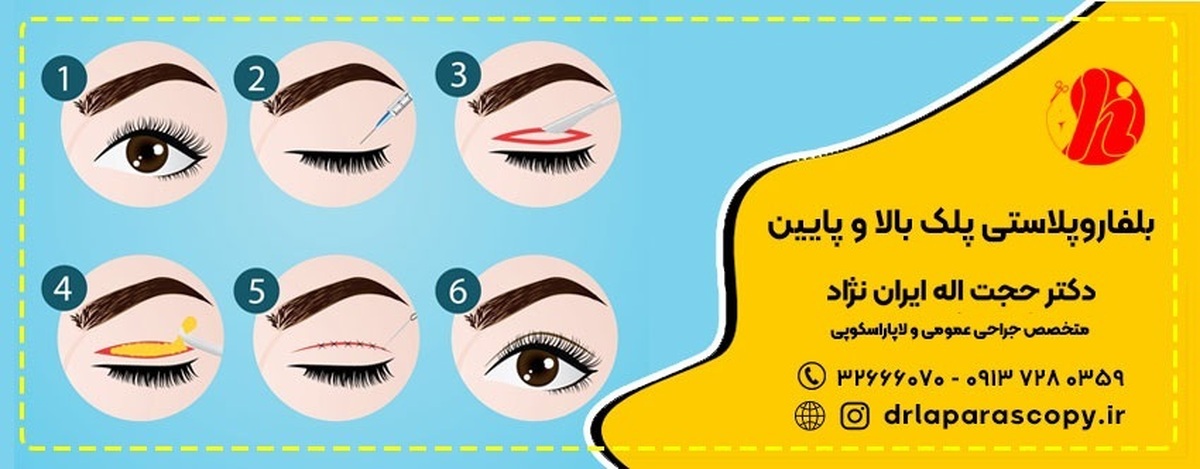 بهترین جراح چشم در اصفهان کیست؟