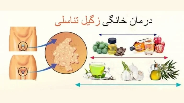 درمان خانگی زگیل تناسلی مردان