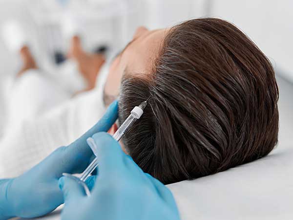 Hair mesotherapy Benefits, durability of results and its price