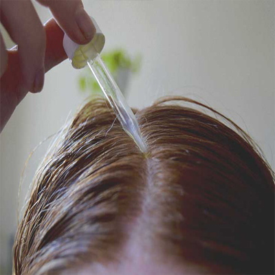 How does minoxidil treat hair loss?