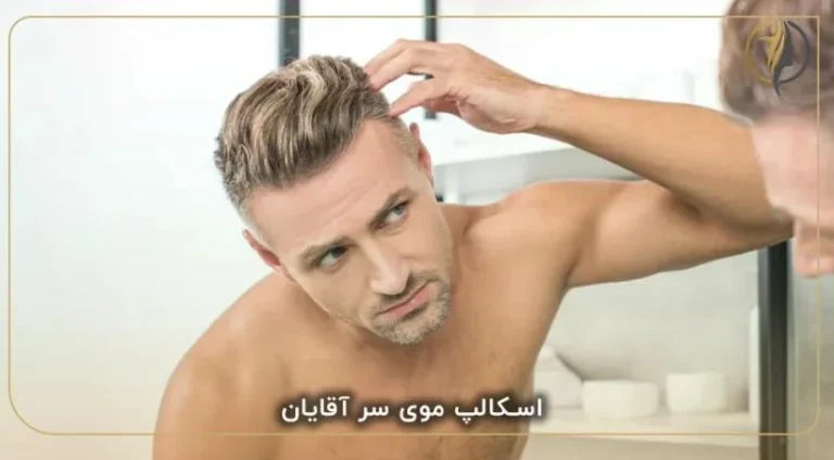 تفاوت اسکالپ موی سر بانوان و آقایان : رویکردی تخصصی به میکروپیگمنتیشن پوست سر