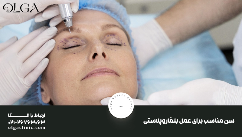 سن مناسب برای عمل بلفاروپلاستی